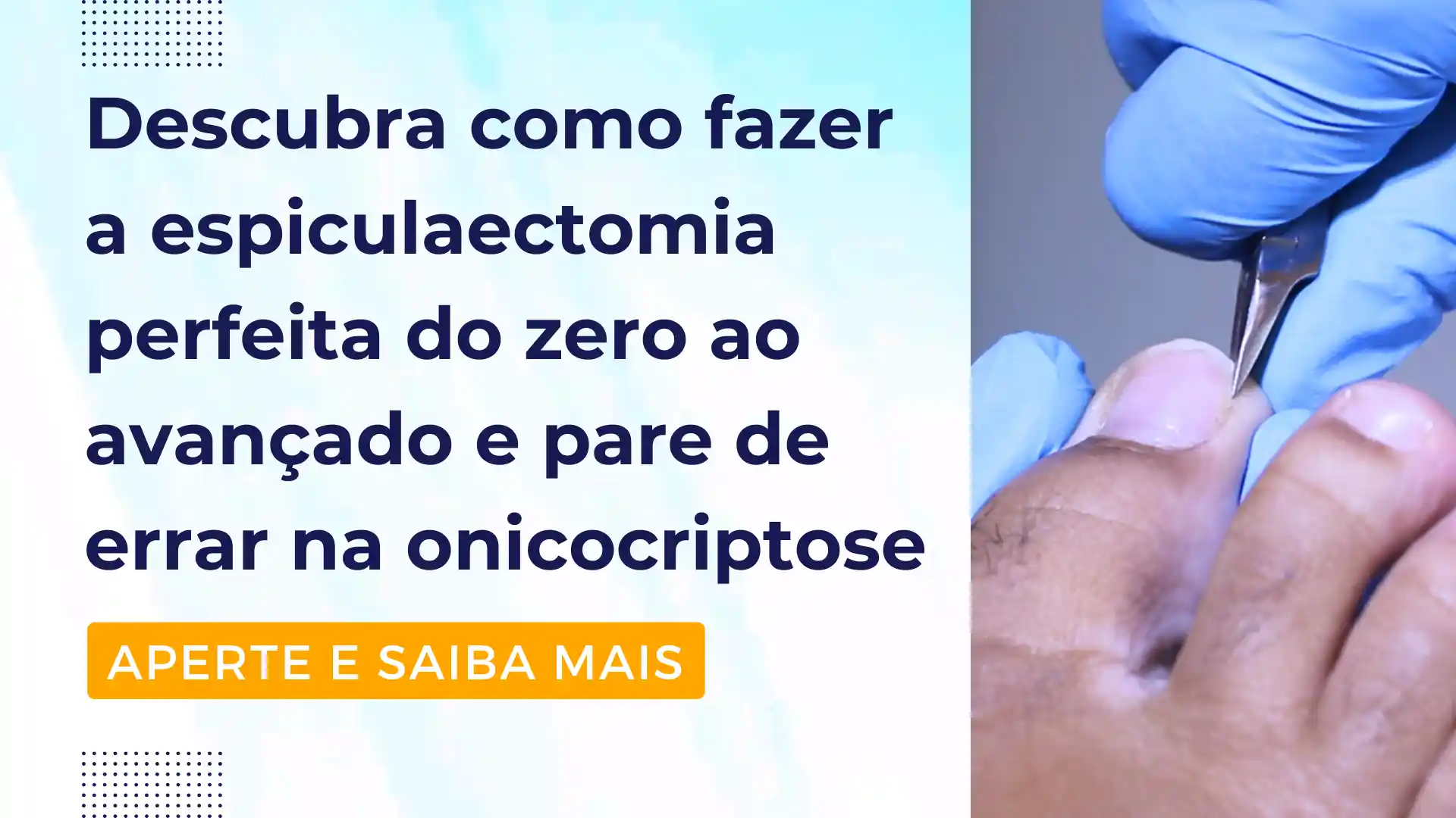 banner curso onicocriptose espiculaectomia