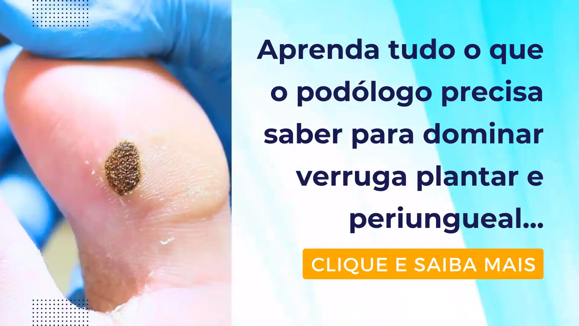 banner curso verruga plantar podologia