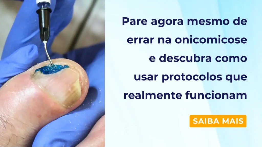 azul de metileno lamina ungueal halux