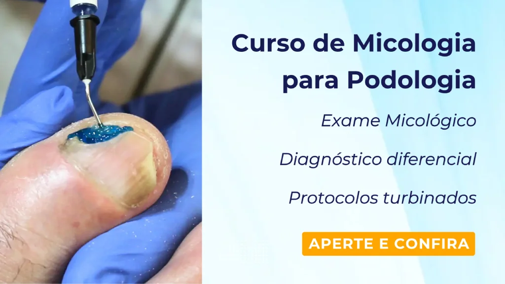 azul de metileno lamina ungueal halux